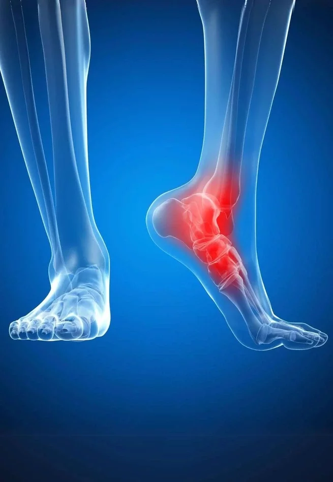 Customised orthotics